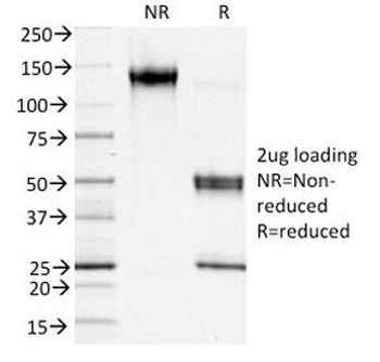 S100A4 Antibody / FSP1