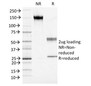 S100A4 Antibody / FSP1