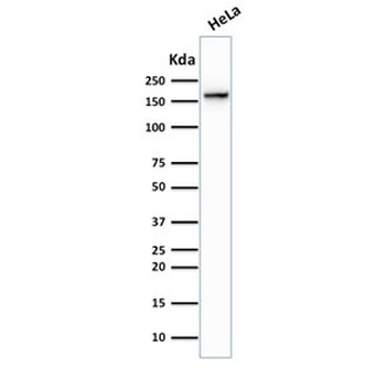 TOP2A Antibody / Topoisomerase II alpha