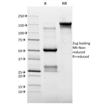 TOP2A Antibody / Topoisomerase II alpha