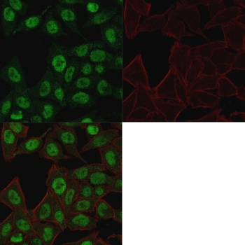 Topoisomerase II alpha Antibody / TOP2A