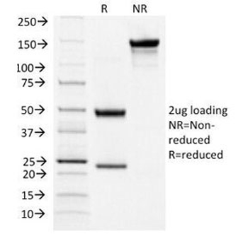 TSHR Antibody (beta chain)