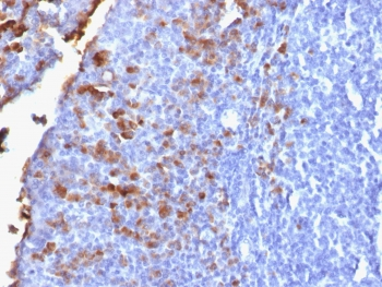 Recombinant IgG Antibody / Rabbit Monoclonal