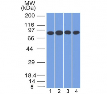 Transferrin Receptor Antibody / TFRC / CD71