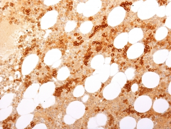 Transferrin Receptor Antibody / TFRC / CD71