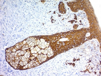 Recombinant Basic Cytokeratin Antibody / Rabbit Monoclonal