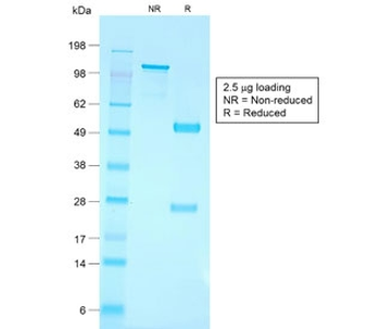 Recombinant CD79a Antibody / Rabbit Monoclonal