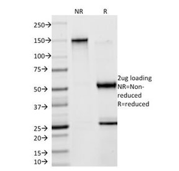 Creatine kinase B Antibody / CKB