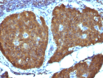 NSE Antibody / Neuron Specific Enolase