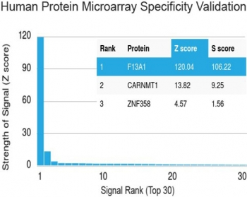 Factor XIIIa Antibody