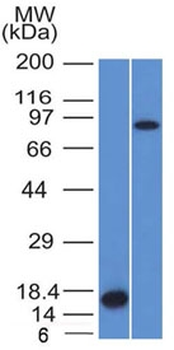 Factor XIIIa Antibody