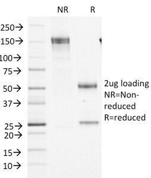 Factor XIIIa Antibody