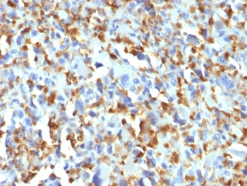 Factor XIIIa Antibody