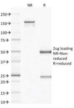 Factor XIIIa Antibody