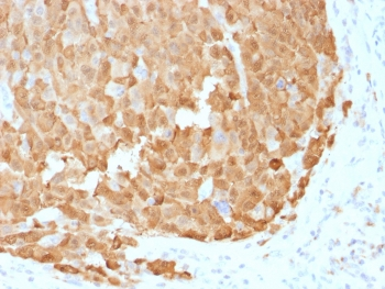 S100A1 Antibody