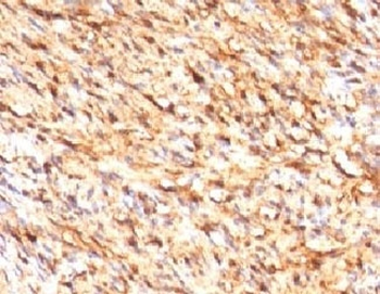 S100 beta Antibody
