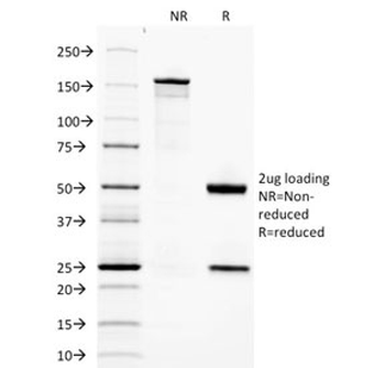 Adiponectin Antibody