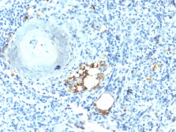 Recombinant TRAcP Antibody / TRAP / ACP5