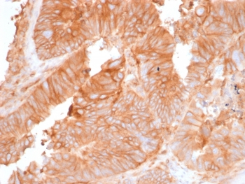 Beta-2 Microglobulin Antibody