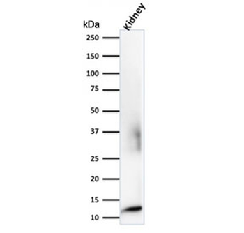 Beta-2 Microglobulin Antibody