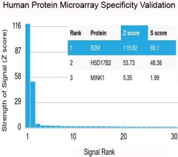 Beta-2 Microglobulin Antibody