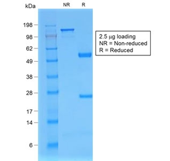 Beta-2 Microglobulin Antibody