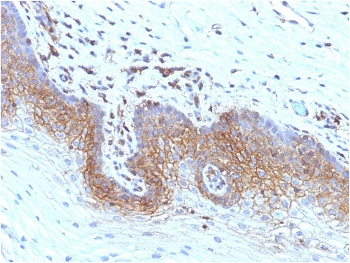 Beta-2 Microglobulin Antibody