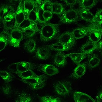 Beta-2 Microglobulin Antibody