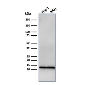 Beta-2 Microglobulin Antibody