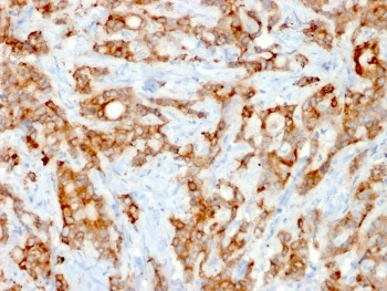 Recombinant Beta-2 Microglobulin Antibody