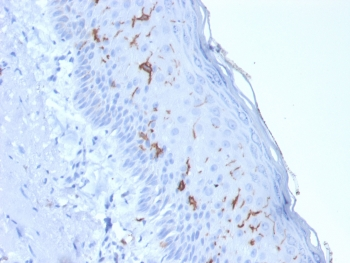 Recombinant CD1a Antibody