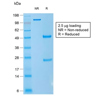 Recombinant CD1a Antibody