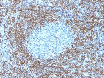 Recombinant Bcl2 Antibody / Rabbit Monoclonal