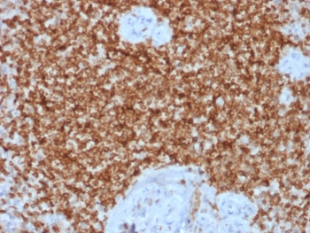 Recombinant Bcl2 Antibody / Rabbit Monoclonal