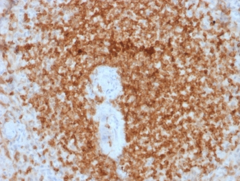 Recombinant Bcl-2 Antibody