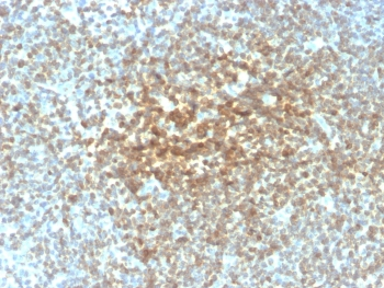 Recombinant Bcl2 Antibody