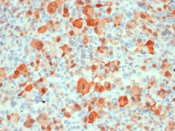 Recombinant S100B Antibody