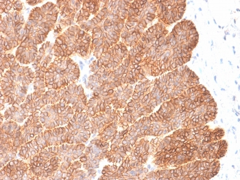 EpCAM Antibody / Extracellular domain