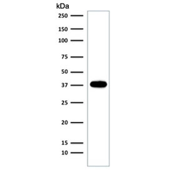 EpCAM Antibody / Extracellular domain