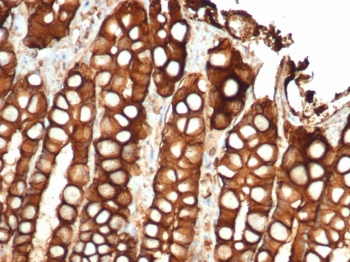 EpCAM Antibody / Extracellular domain