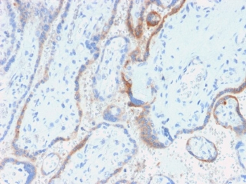 Recombinant HCG-beta Antibody