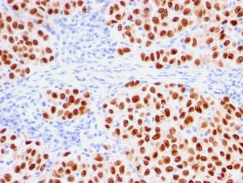 Recombinant SOX10 Antibody