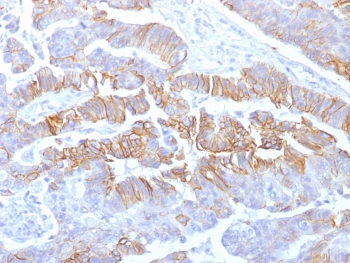 E-Cadherin Antibody / CDH1
