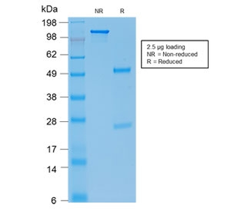E-Cadherin Antibody / CDH1