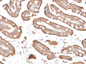 Recombinant Villin Antibody / VIL1