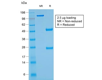 Recombinant ANO1 Antibody / DOG1 / TMEM16A