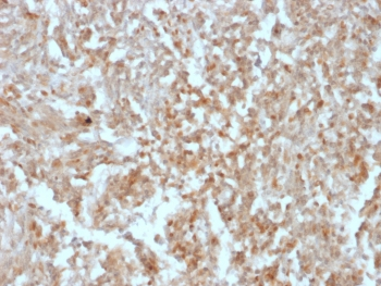 Recombinant ANO1 Antibody / DOG1 / TMEM16A