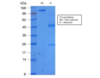 Recombinant EpCAM Antibody / Extracellular domain