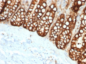 Recombinant EpCAM Antibody / Extracellular domain