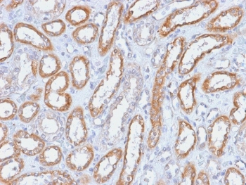 Recombinant Integrin beta 3 Antibody / ITGB3 / CD61